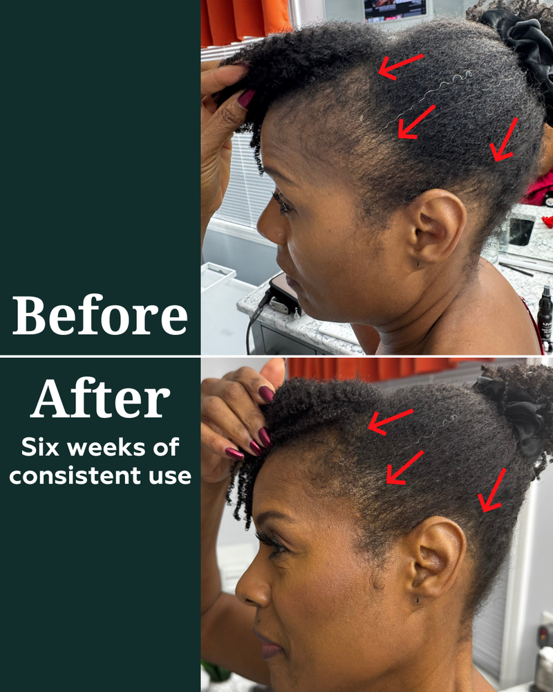 Deep Density Peptide Tonic for Visibly Thicker, Denser, & Fuller Hair