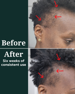 Deep Density Peptide Tonic for Visibly Thicker, Denser, & Fuller Hair