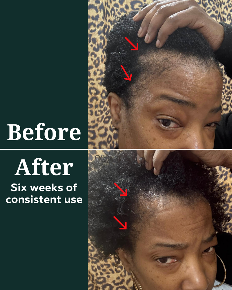 Deep Density Peptide Tonic for Visibly Thicker, Denser, & Fuller Hair