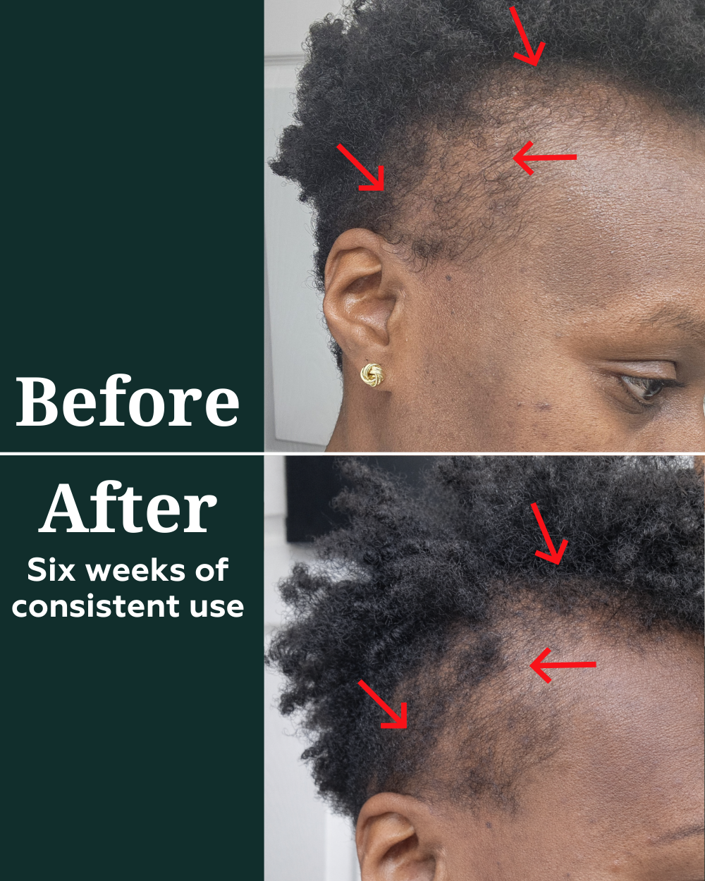 Deep Density Peptide Tonic for Visibly Thicker, Denser, & Fuller Hair