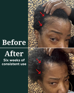 Deep Density Peptide Tonic for Visibly Thicker, Denser, & Fuller Hair