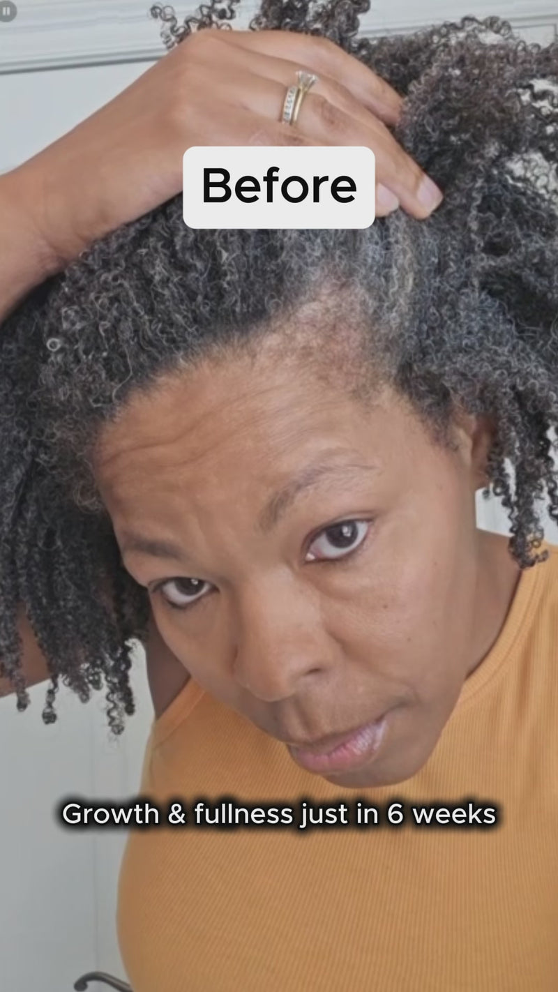 Deep Density Peptide Tonic for Visibly Thicker, Denser, & Fuller Hair
